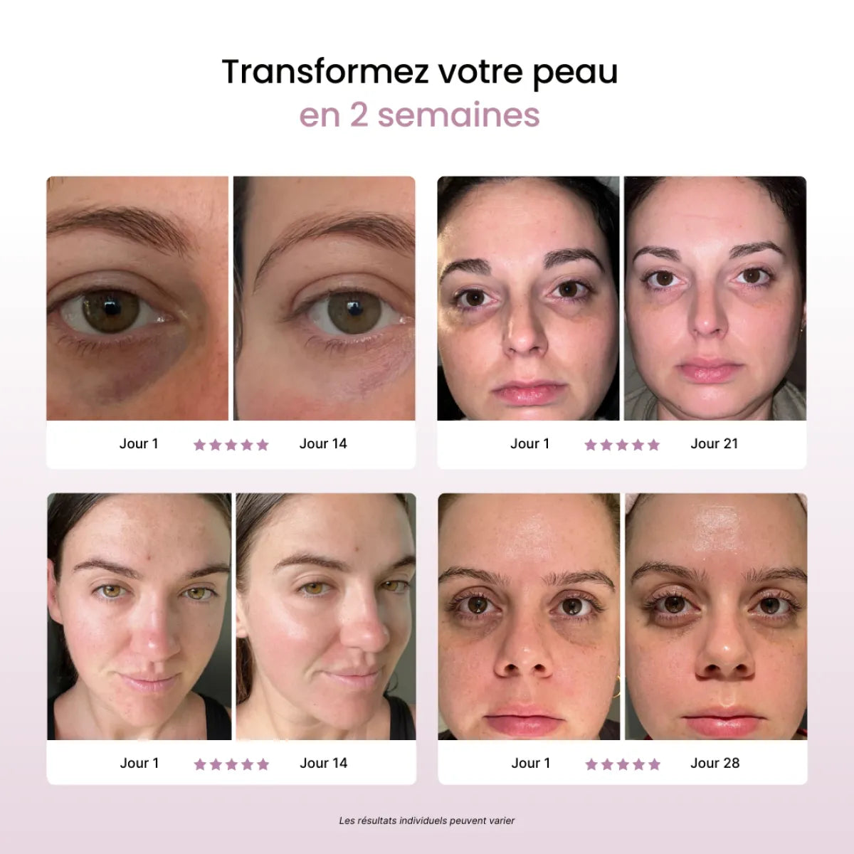 Faceglow© Appareil soin de la peau anti-âge et cernes lumière rouge