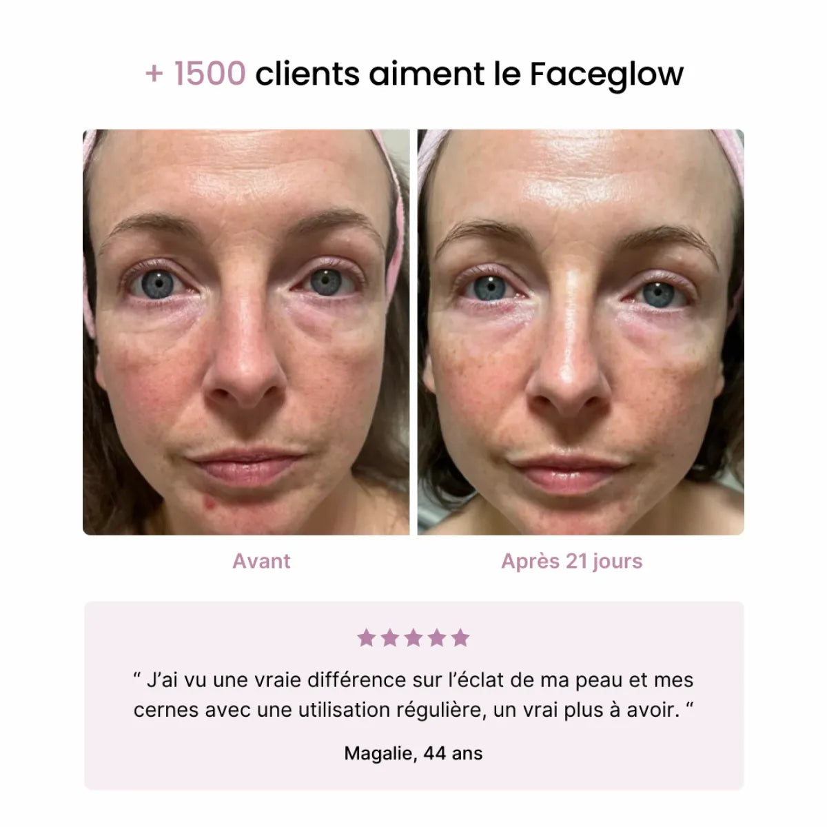 Faceglow© Appareil soin de la peau anti-âge et cernes lumière rouge